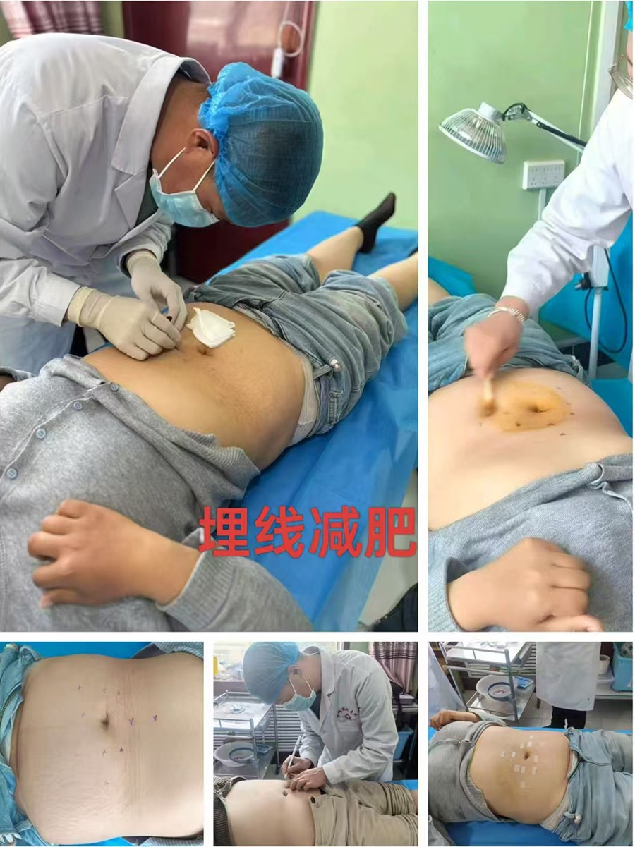【杏林妙手】羅國寶：扎根基層，以中醫妙術守護百姓安康